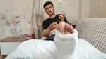 Ters yönden gelen otomobil, motosikletlinin bacağını kırdı, sürücü kaçtı!
